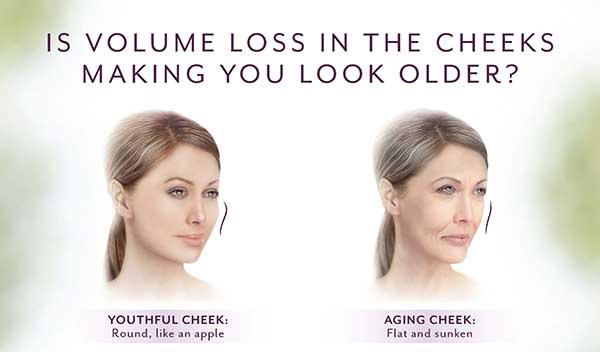 As you age, it’s not just about lines and wrinkles. Your cheeks also lose volume and the skin may sag. That’s why a more youthful profile starts with the apples of your cheeks.
