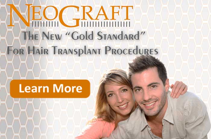Neograft, The New Gold Standard in Hair Transplant Procedures
