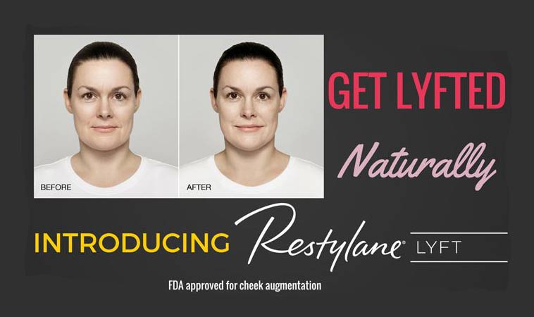 Get Lyfted, new FDA Approved Restylane Lyft | Contour Dermatology Get Lyfted, new FDA Approved Restylane Lyft