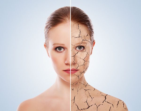 low-humidity-dry-skin