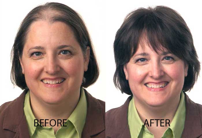 female-before-after