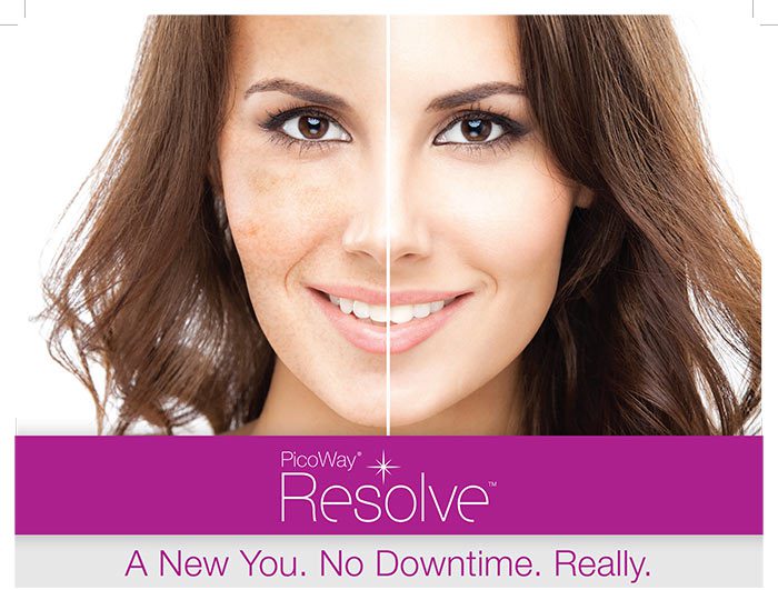 Brown spots and areas of uneven pigmentation become things of the past with PicoWay. | Contour Dermatology Brown spots and areas of uneven pigmentation become things of the past with PicoWay.