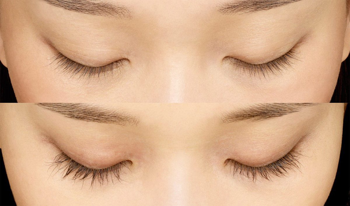 20190314-Latisse-before-after-2-lg | Contour Dermatology Before Latisse® and at week 16