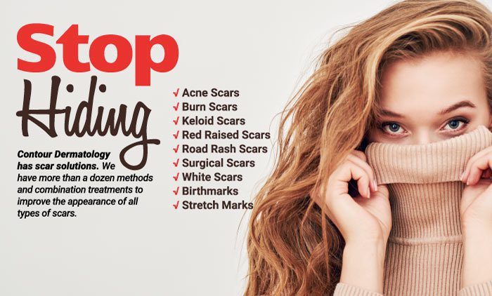 Contour Dermatology Scar Solutions | Contour Dermatology Contour Dermatology Scar Solutions
