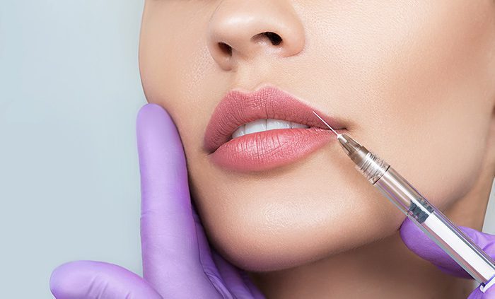 Restylane KYSSE | Contour Dermatology Restylane KYSSE