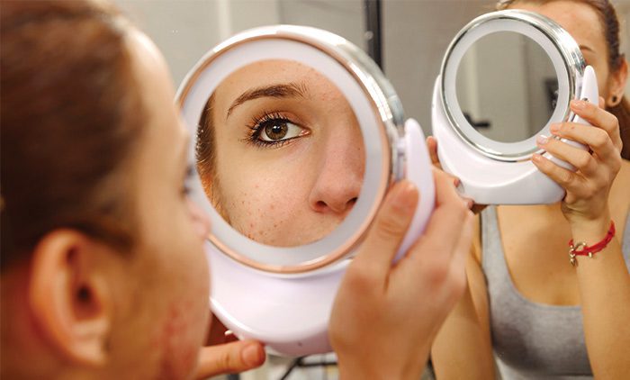 20200310-pimple-package-web | Contour Dermatology Girl looking in mirror